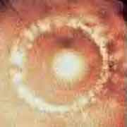 distilled water crystal by Emoto