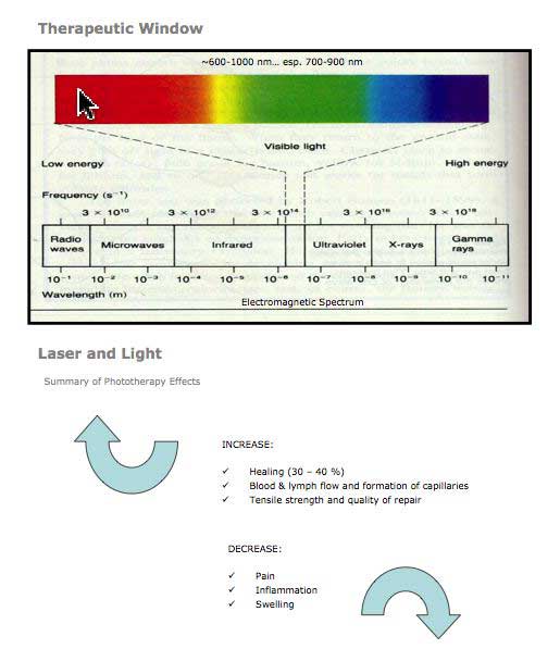 Nm Laser Chart